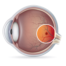 eye-1