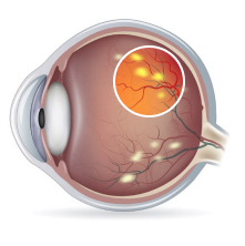 eye-3