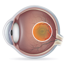 eye-4